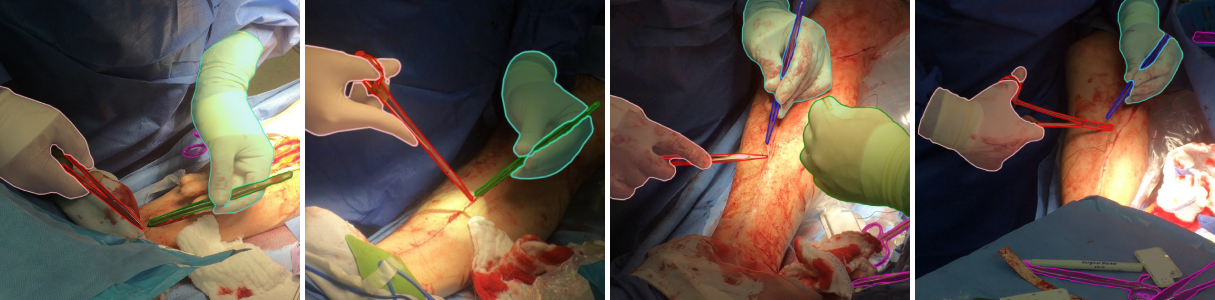 Annotated segmentation masks of surgical tools and hands